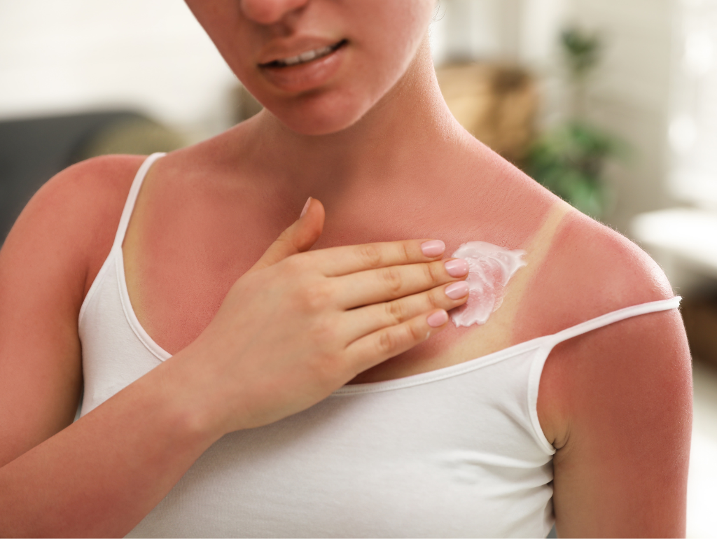 Sunscreen for Sensitive Skin: Tips and Recommendations