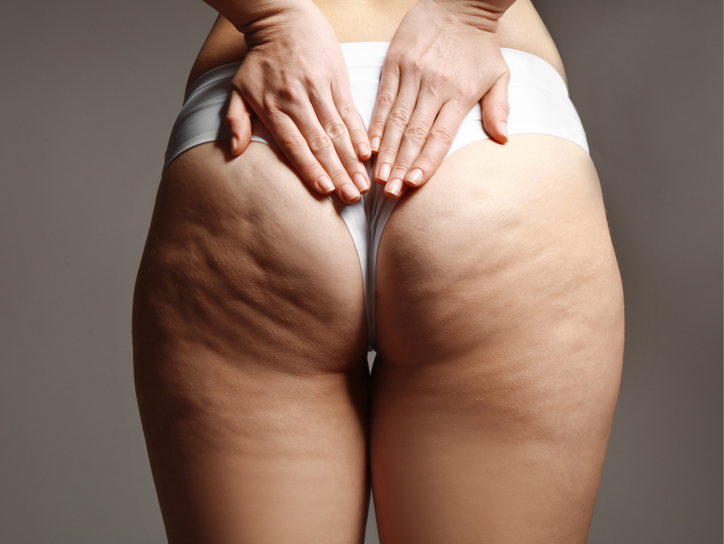 Buttocks: When Your Seat of Power Becomes a Source of Insecurity