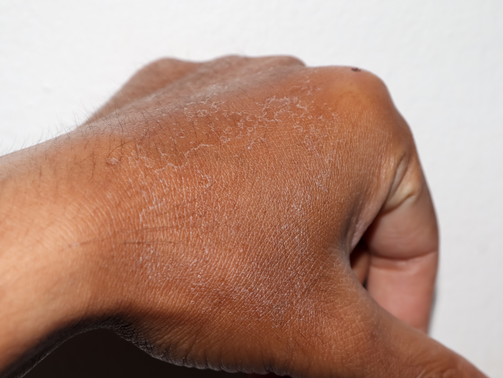 Dry Skin: The Foundation Issue That's More Complex Than You Think