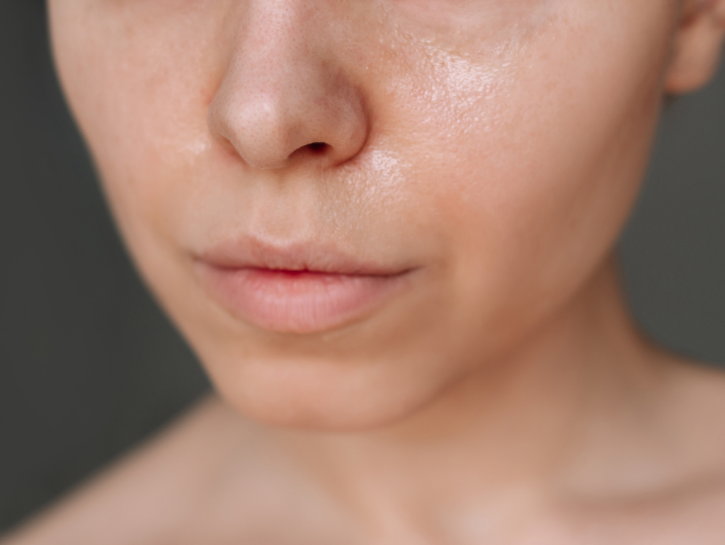 Excessive Oil: When Your Face Becomes a Slip-and-Slide