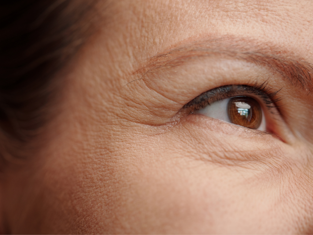 Fine Lines & Wrinkles: When Time Starts Writing Its Story on Your Face