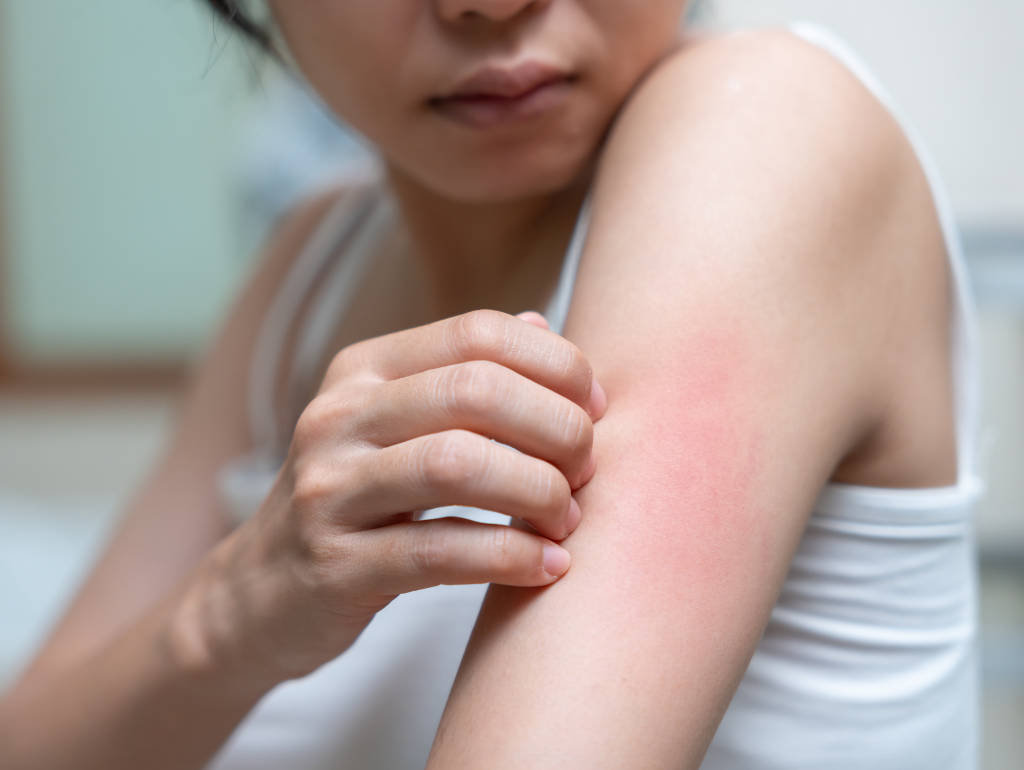 Itchy Skin: When Your Face Becomes Your Worst Enemy
