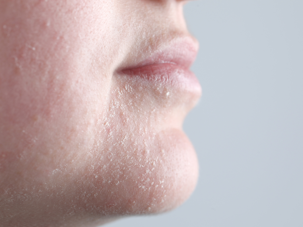 Rough Skin: When Your Body Feels Like a Pumice Stone